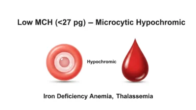 MCH Meaning in Blood Test